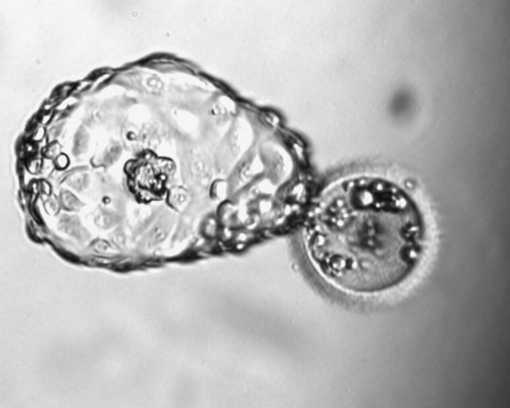 Hatching Blastocyst