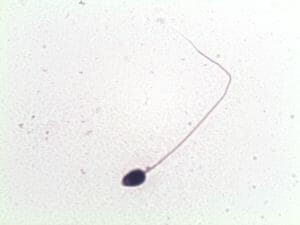 Normal Sperm