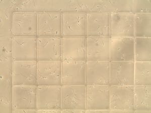 Sperm Counting