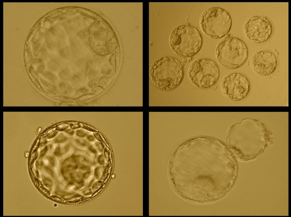 Morphologically Normal Blastocysts