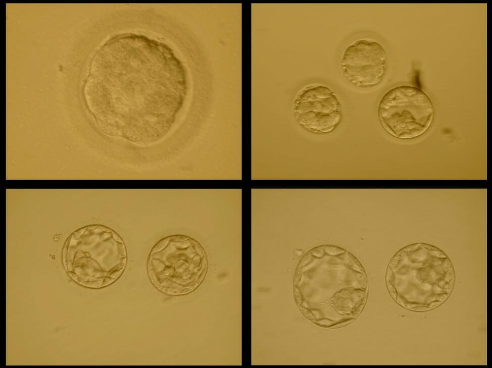 Morula to Blastocyst Embryogenesis
