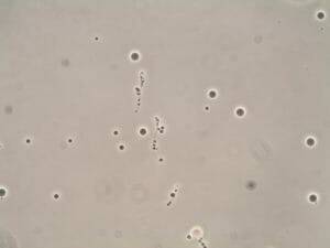 Antisperm Antibodies