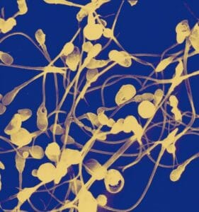 Scanning Electron Micrograph of Semen