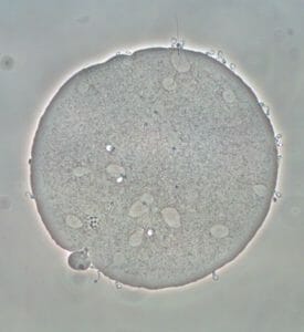 Sperm Penetration Assay (SPA)