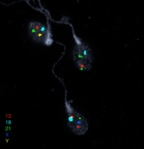 Sperm Chromosome Aneuploidy