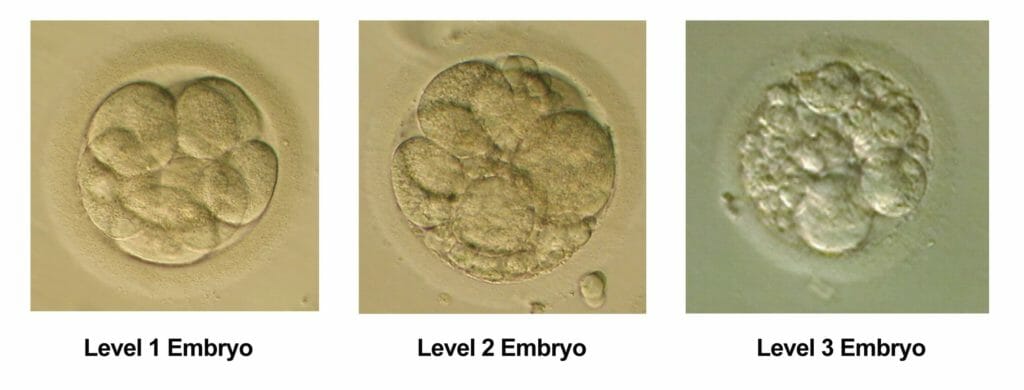Cleavage Stage Embryo Grading